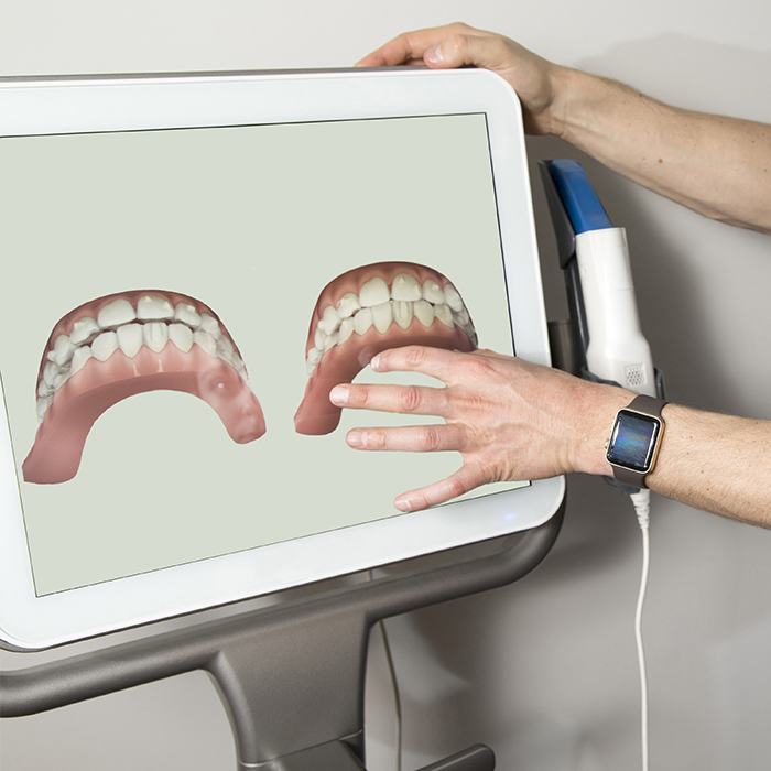 Invisalign treatment plan on chairside computer